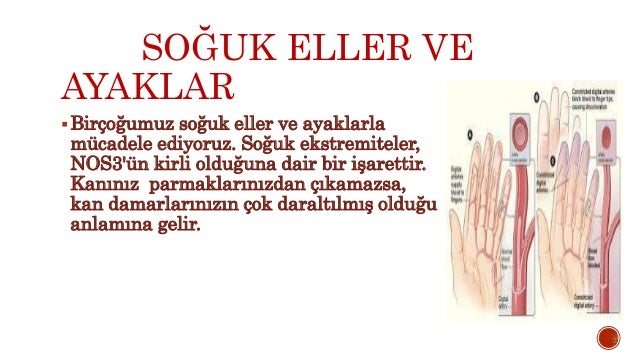 Ayak Ülseri: Bir problemle mücadele ediyoruz Ayak Ülseri: Bir problemle mücadele ediyoruz